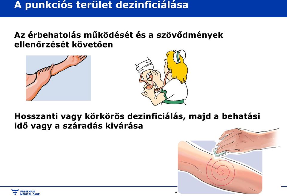 ellenőrzését követően Hosszanti vagy körkörös