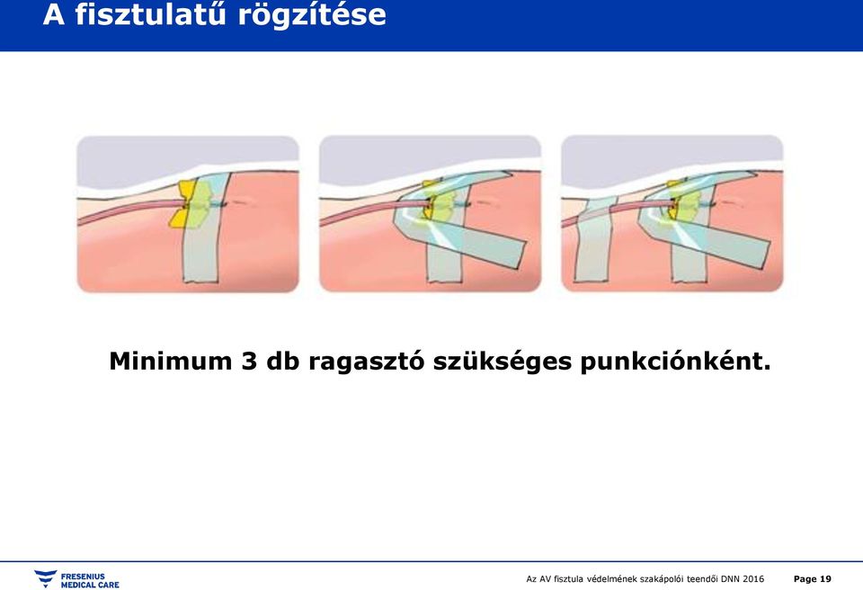 3 db ragasztó