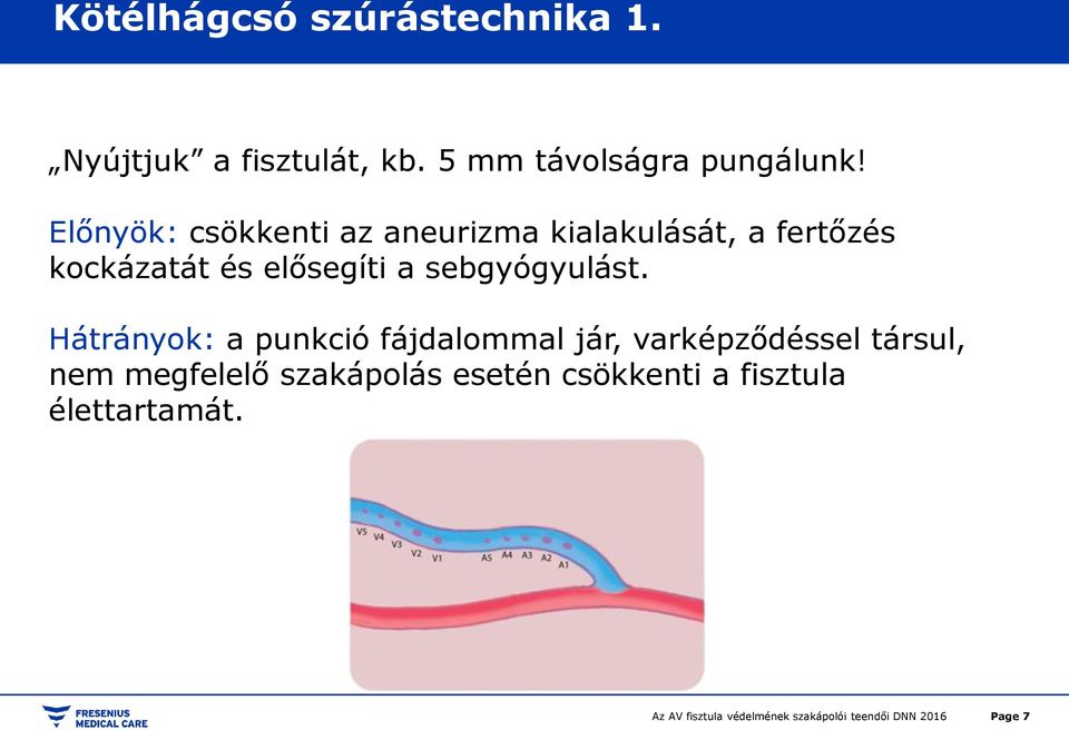 Előnyök: csökkenti az aneurizma kialakulását, a fertőzés kockázatát és