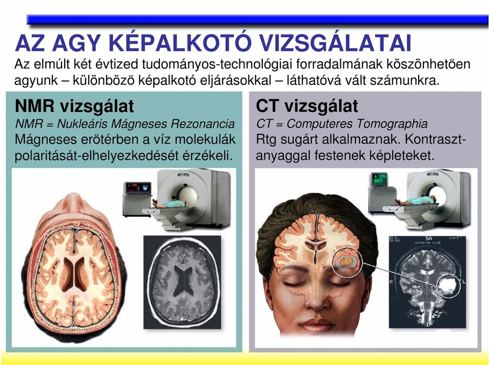 NMR vizsgálat NMR = Nukleáris Mágneses Rezonancia Mágneses erıtérben a víz molekulák