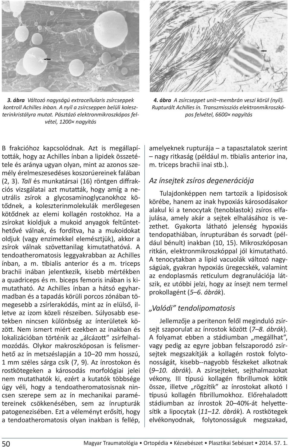 Azt is megállapították, hogy az Achilles ínban a lipidek összetétele és aránya ugyan olyan, mint az azonos személy érelmeszesedéses koszorúereinek falában (2, 3).