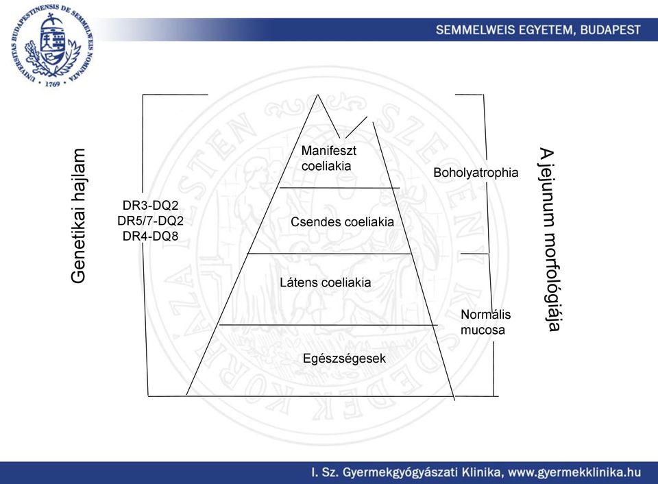 DR5/7-DQ2 DR4-DQ8 Csendes coeliakia