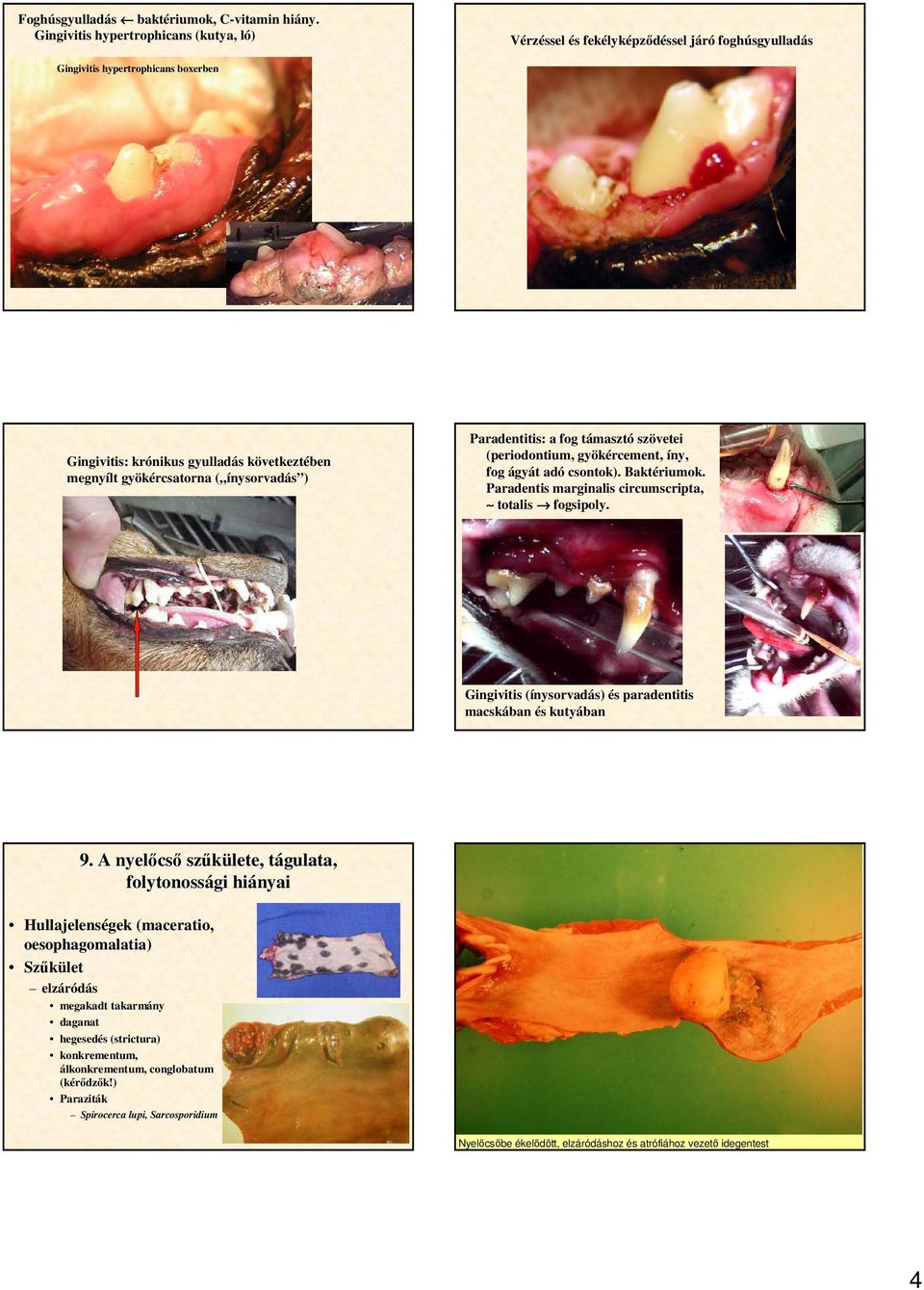 ínysorvadás ) Paradentitis: a fog támasztó szövetei (periodontium, gyökércement, íny, fog ágyát adó csontok). Baktériumok. Paradentis marginalis circumscripta, totalis fogsipoly.