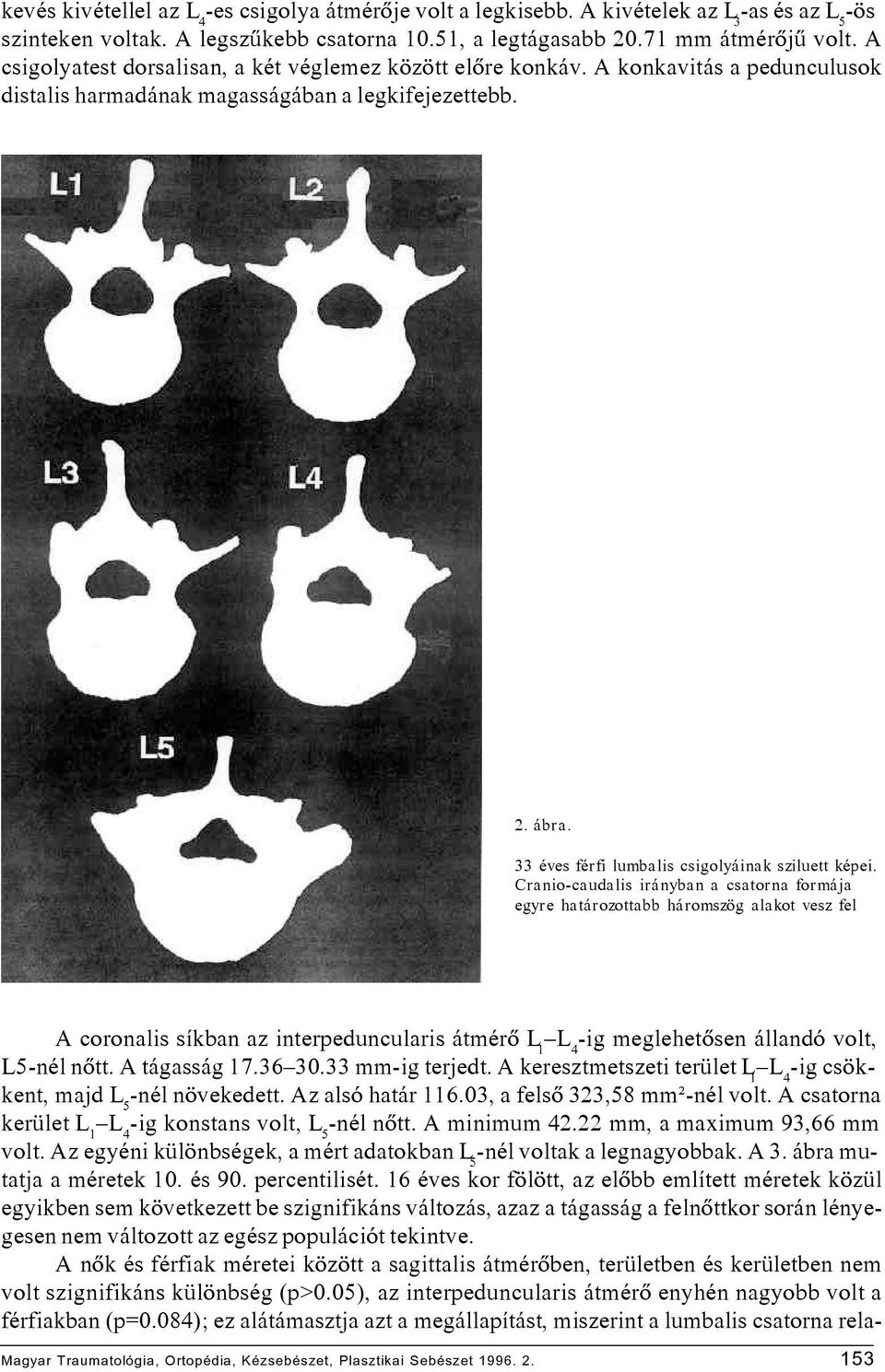 33 éves férfi lumbalis csigolyáinak sziluett képei.