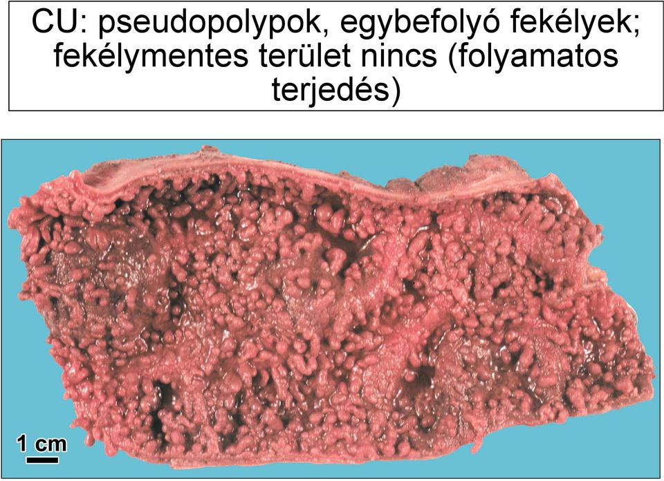 fekélymentes terület