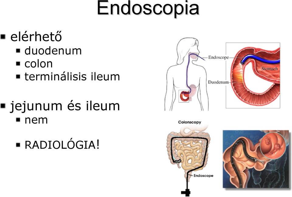 ileum jejunum és