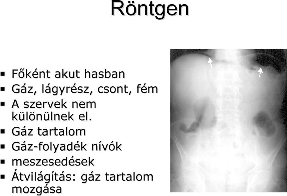 Gáz tartalom Gáz-folyadék nívók