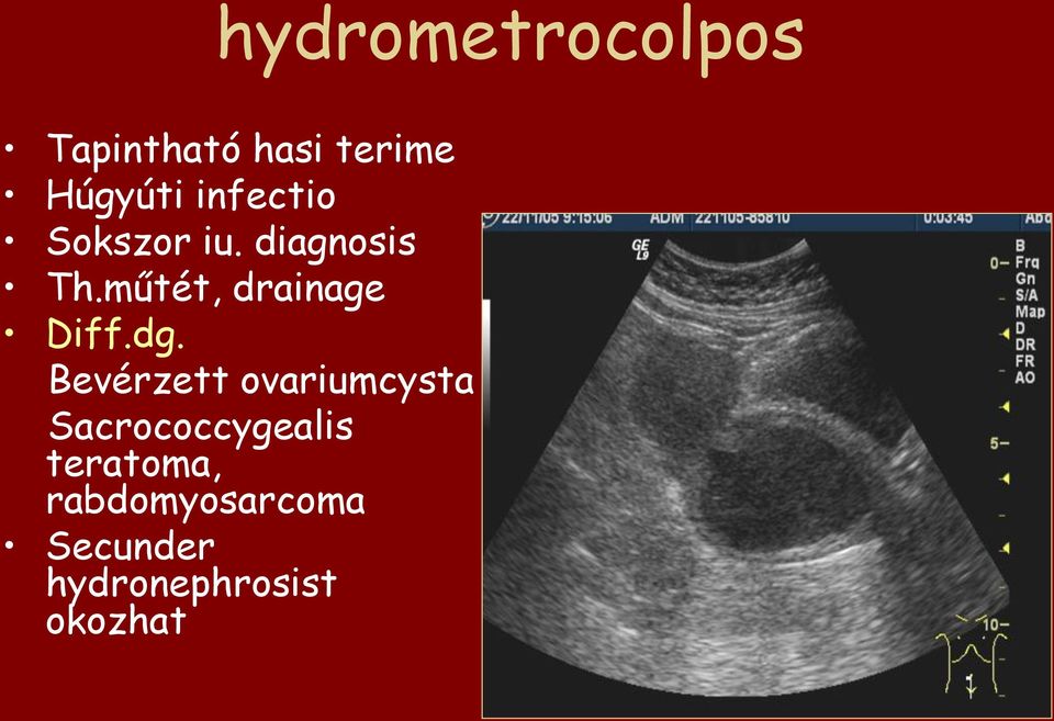 műtét, drainage Diff.dg.