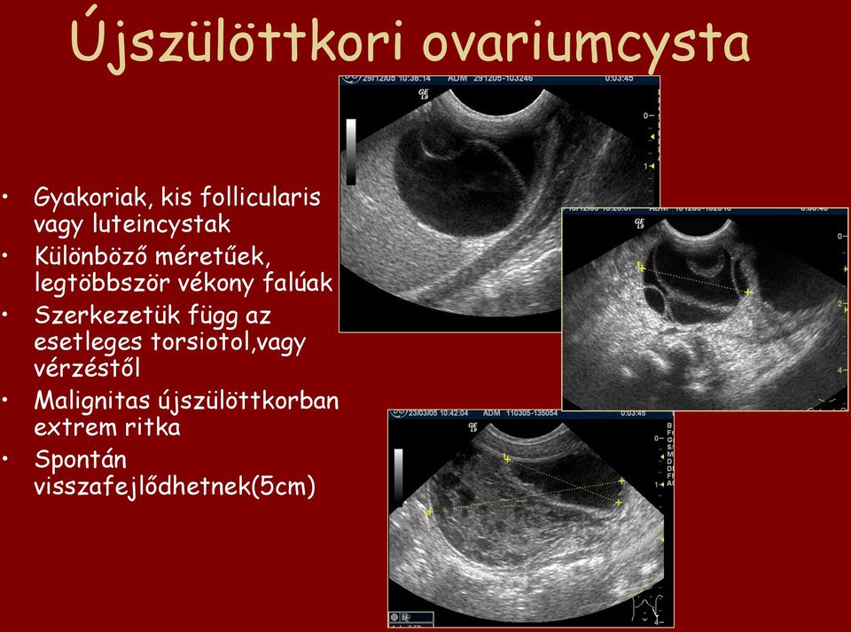 Szerkezetük függ az esetleges torsiotol,vagy vérzéstől