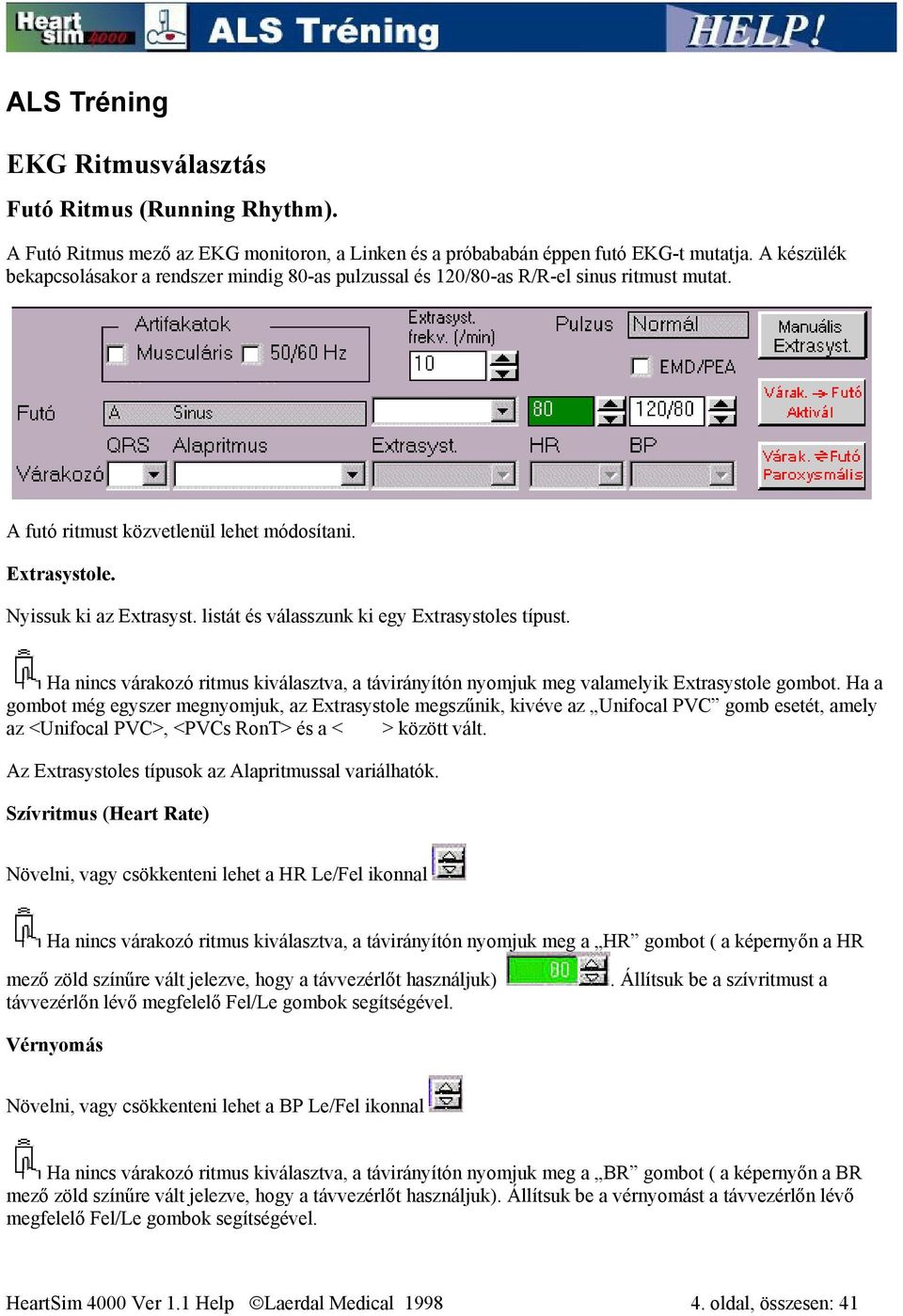 listát és válasszunk ki egy Extrasystoles típust. Ha nincs várakozó ritmus kiválasztva, a távirányítón nyomjuk meg valamelyik Extrasystole gombot.