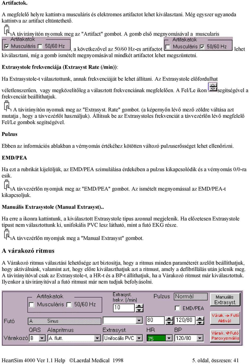 A gomb első megnyomásával a muscularis, a következővel az 50/60 Hz-es artifactot lehet kiválasztani, míg a gomb ismételt megnyomásával mindkét artifactot lehet megszüntetni.