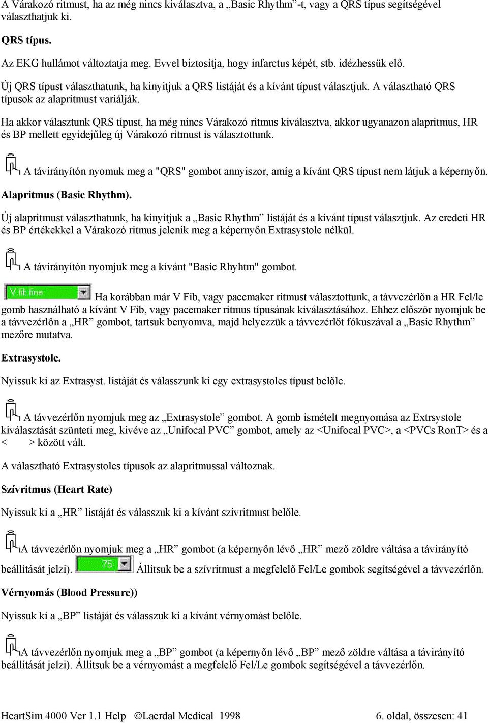 Ha akkor választunk QRS típust, ha még nincs Várakozó ritmus kiválasztva, akkor ugyanazon alapritmus, HR és BP mellett egyidejűleg új Várakozó ritmust is választottunk.