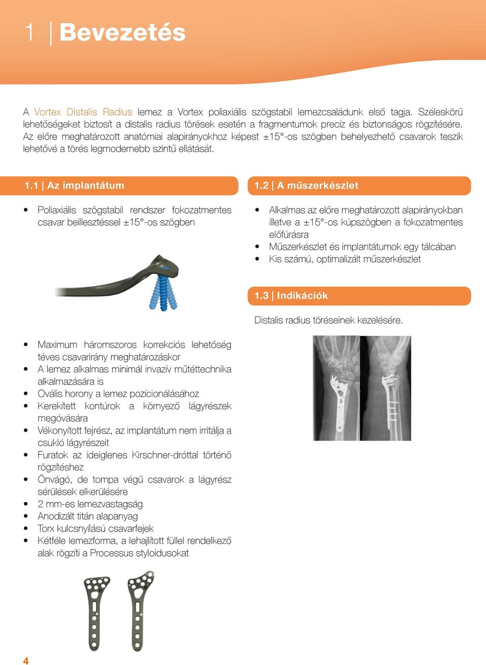 Az előre meghatározott anatómiai alapirányokhoz képest ±15 -os szögben behelyezhető csavarok teszik lehetővé a törés legmodernebb szintű ellátását. 1.1 Az implantátum 1.