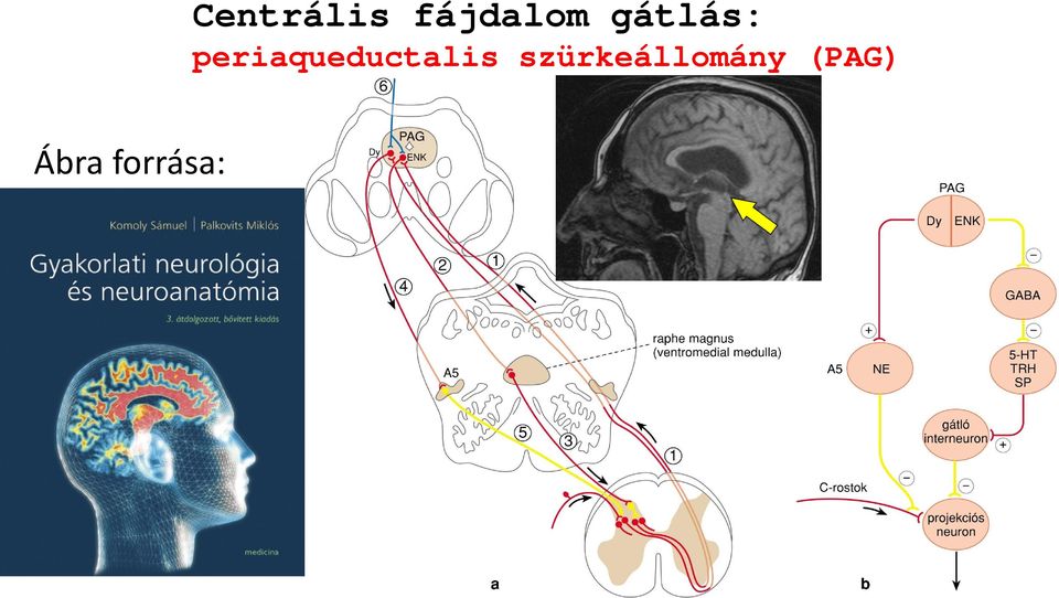 gátlás: