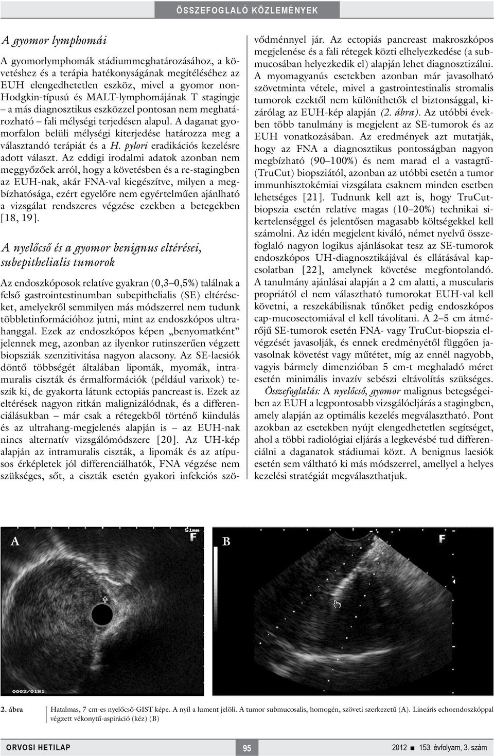 A daganat gyomorfalon belüli mélységi kiterjedése határozza meg a választandó terápiát és a H. pylori eradikációs kezelésre adott választ.