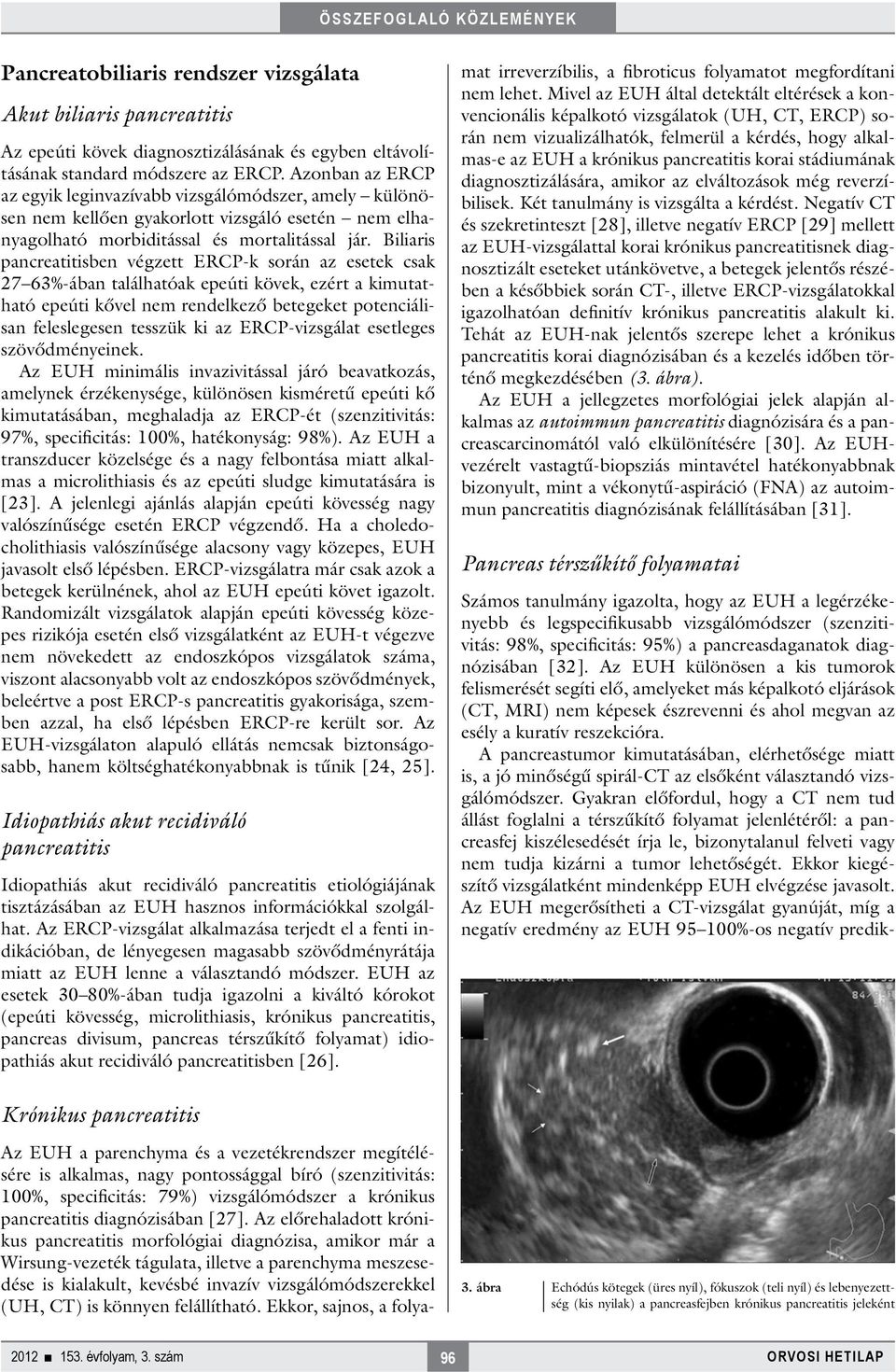 Biliaris pancreatitisben végzett ERCP-k során az esetek csak 27 63%-ában találhatóak epeúti kövek, ezért a kimutatható epeúti kővel nem rendelkező betegeket potenciálisan feleslegesen tesszük ki az