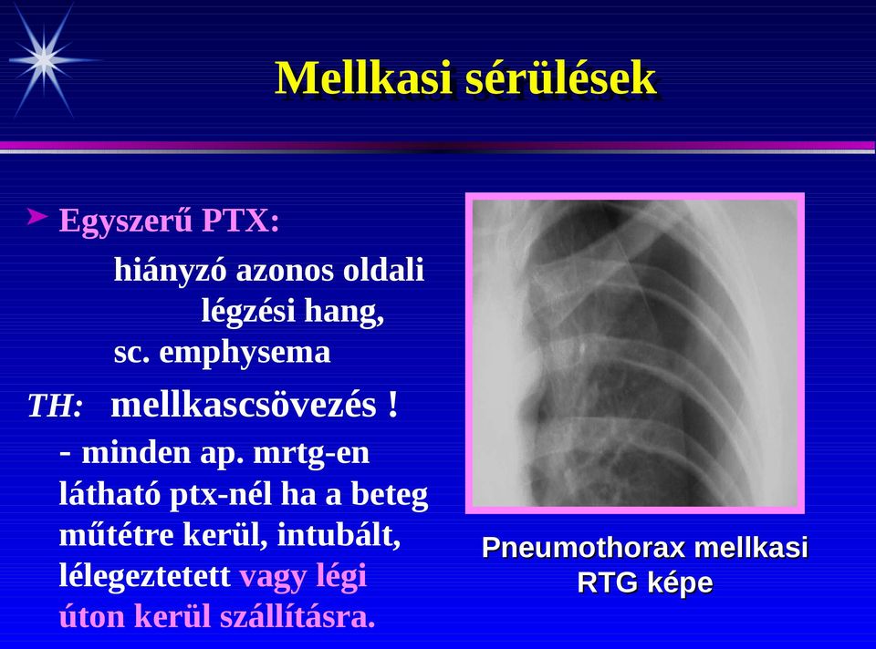 mrtg-en látható ptx-nél ha a beteg műtétre kerül, intubált,