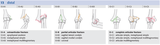 DISTÁLIS HUMERUS TÖRÉSEK