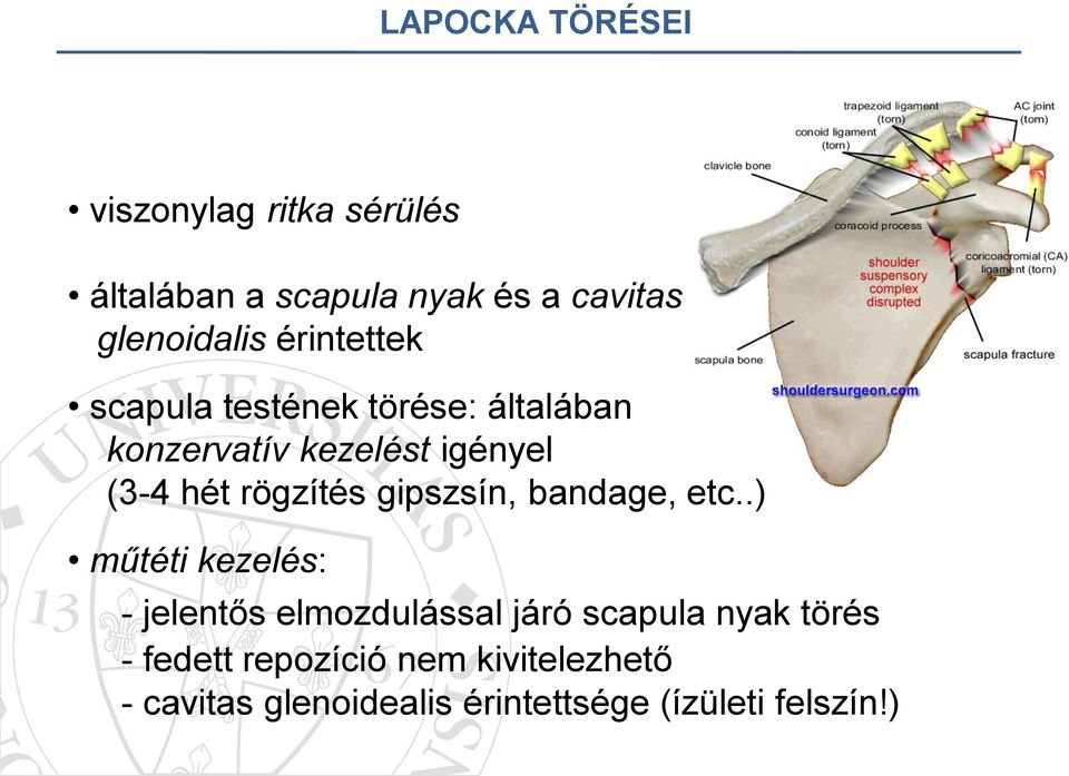 rögzítés gipszsín, bandage, etc.