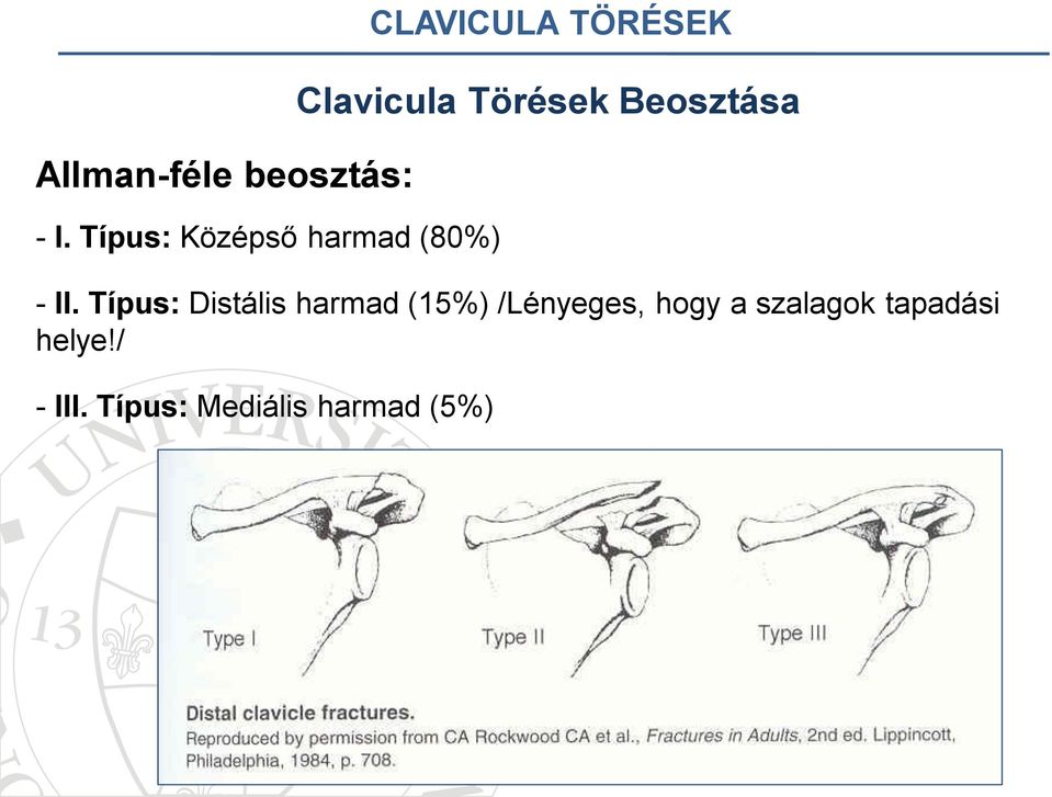 Clavicula Törések Beosztása - II.