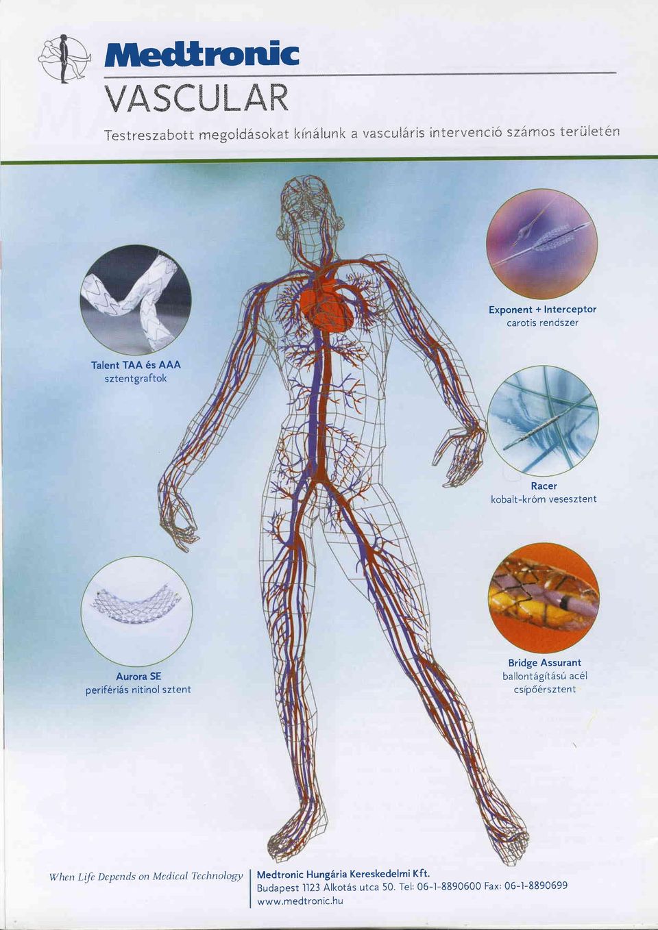 perif6riäs nitinol sztent Bridge Assurant ballontägitäsü ac6l csrp66rsztent When Life Dcpends on Medical Tcchnology