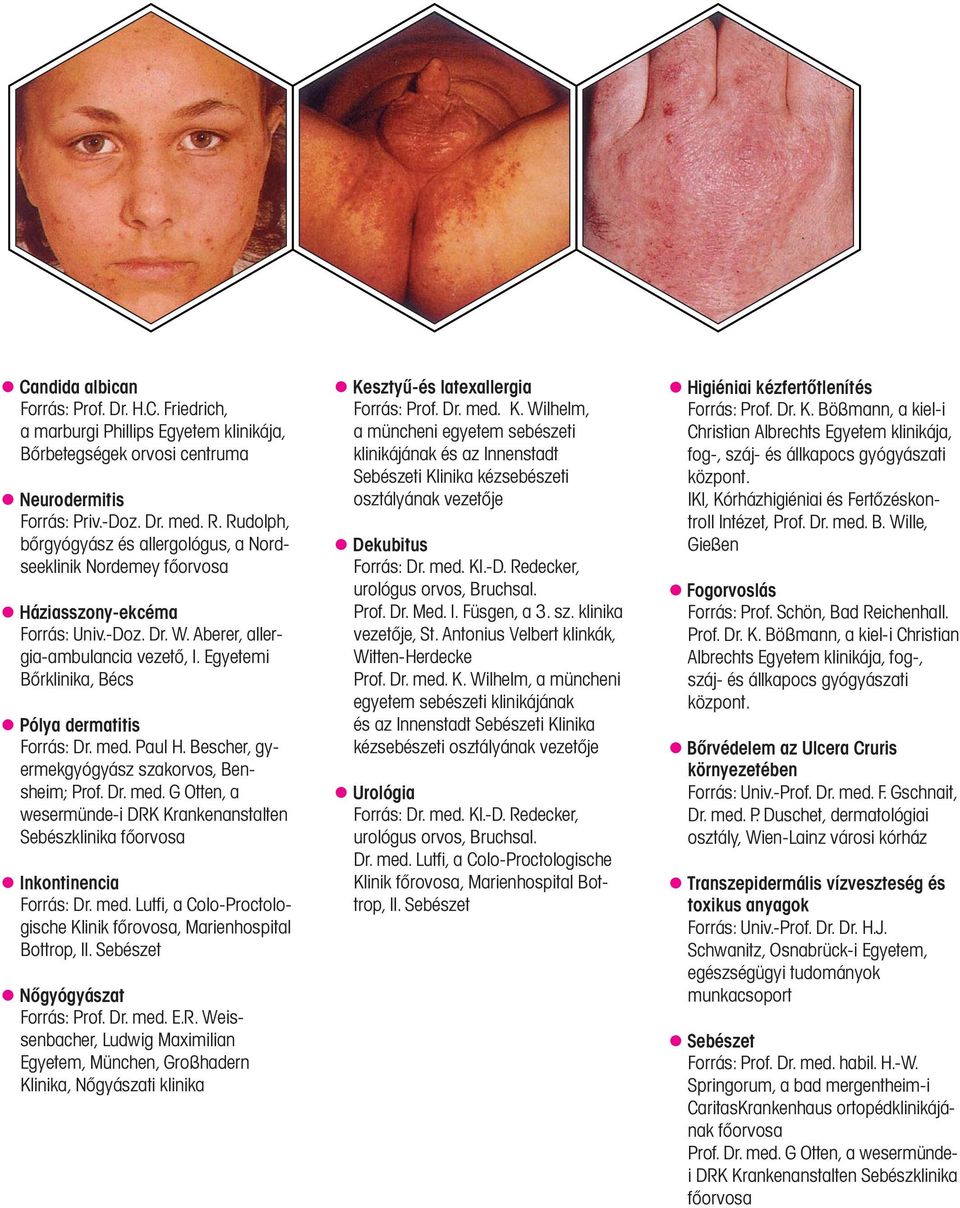 Egyetemi Bőrklinika, Bécs Pólya dermatitis Forrás: Dr. med. Paul H. Bescher, gyermekgyógyász szakorvos, Bensheim; Prof. Dr. med. G Otten, a wesermünde-i DRK Krankenanstalten Sebészklinika főorvosa Inkontinencia Forrás: Dr.