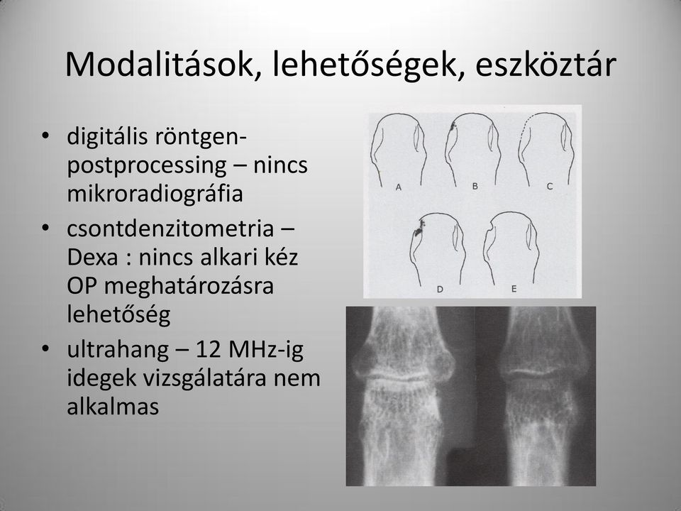 csontdenzitometria Dexa : nincs alkari kéz OP