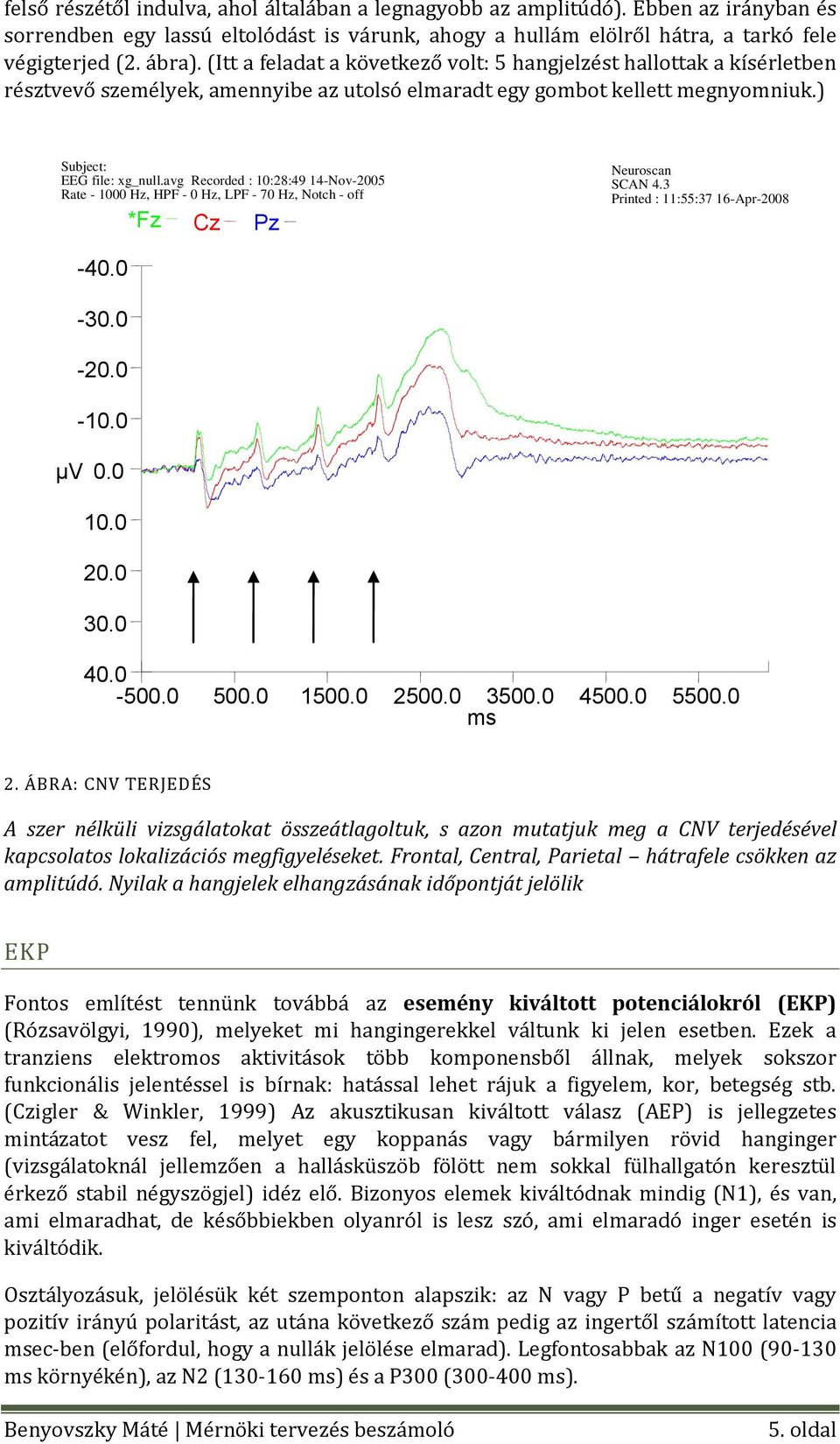 avg Recorded : 10:28:49 14-Nov-2005 Rate - 1000 Hz, HPF - 0 Hz, LPF - 70 Hz, Notch - off *Fz Cz Pz Neuroscan SCAN 4.3 Printed : 11:55:37 16-Apr-2008-40.0-30.0-20.0-10.0 µv 0.0 10.0 20.0 30.0 40.0-500.