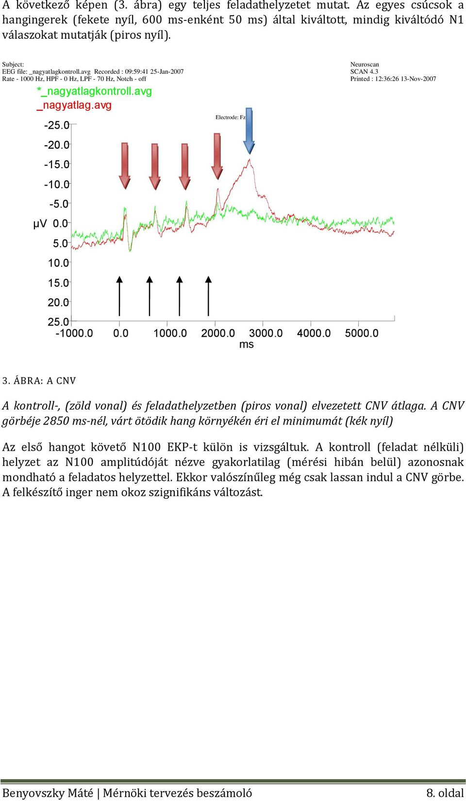 0 10.0 15.0 20.0 Electrode: Fz 25.0-1000.0 0.0 1000.0 2000.0 3000.0 ms 4000.0 5000.0 Neuroscan SCAN 4.3 Printed : 12:36:26 13-Nov-2007 3.