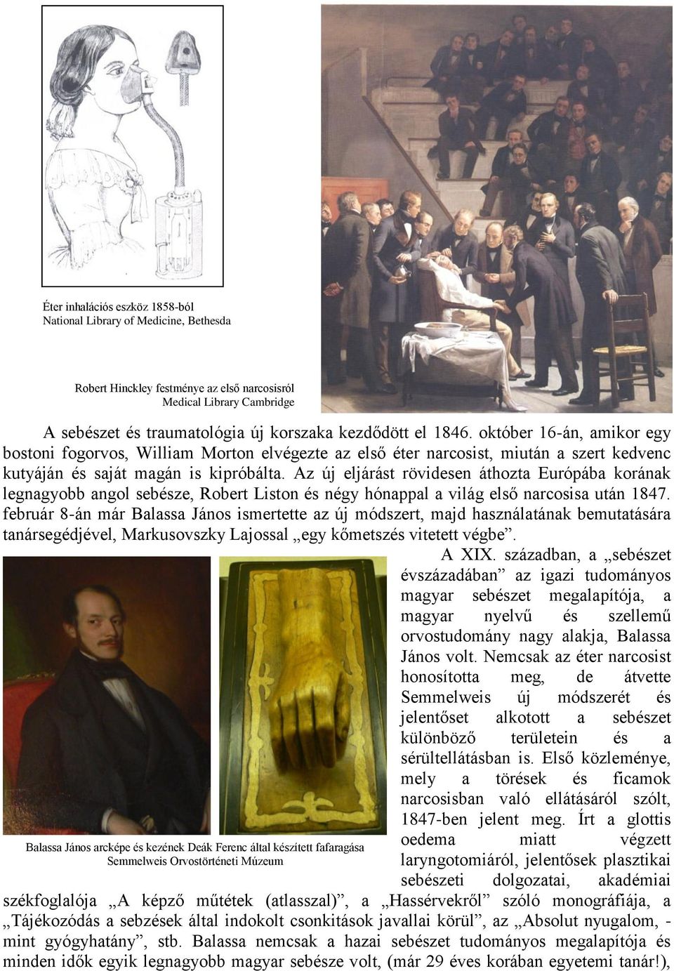 Az új eljárást rövidesen áthozta Európába korának legnagyobb angol sebésze, Robert Liston és négy hónappal a világ első narcosisa után 1847.