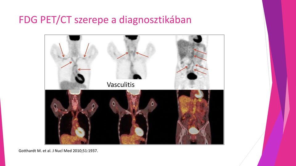 Vasculitis Gotthardt M.