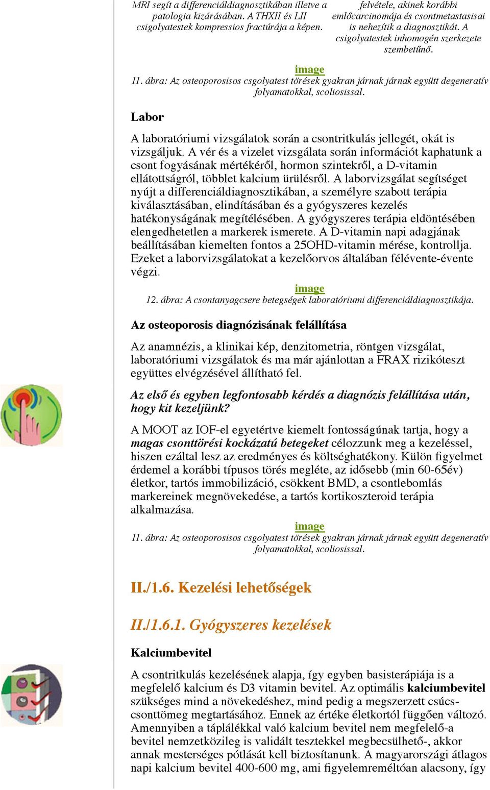 ábra: Az osteoporosisos csgolyatest törések gyakran járnak járnak együtt degeneratív folyamatokkal, scoliosissal. Labor A laboratóriumi vizsgálatok során a csontritkulás jellegét, okát is vizsgáljuk.