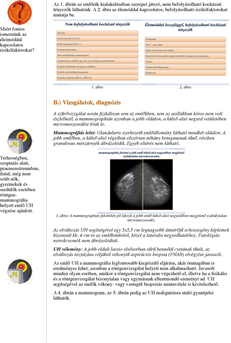 ) Vizsgálatok, diagnózis A szűrővizsgálat során fizikálisan sem az emlőkben, sem az axillákban kóros nem volt észlelhető, a mammographián azonban a jobb oldalon, a külső-alsó negyed vetületében