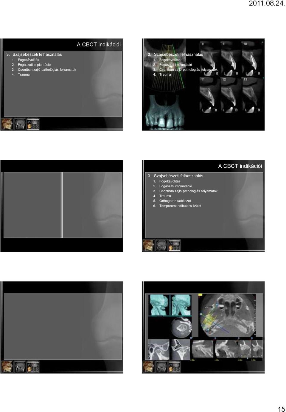 Trauma  Csontban zajló pathológiás folyamatok 4. Trauma 5. Orthognath sebészet 6.