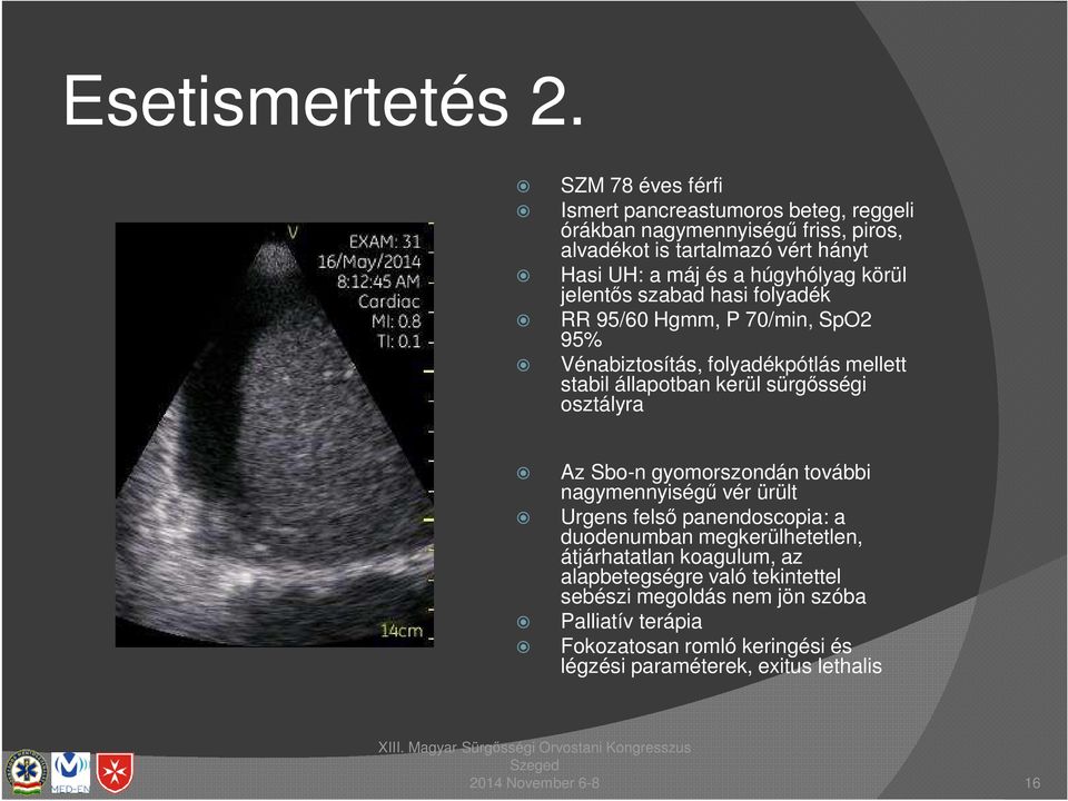 húgyhólyag körül jelentős szabad hasi folyadék RR 95/60 Hgmm, P 70/min, SpO2 95% Vénabiztosítás, folyadékpótlás mellett stabil állapotban kerül sürgősségi