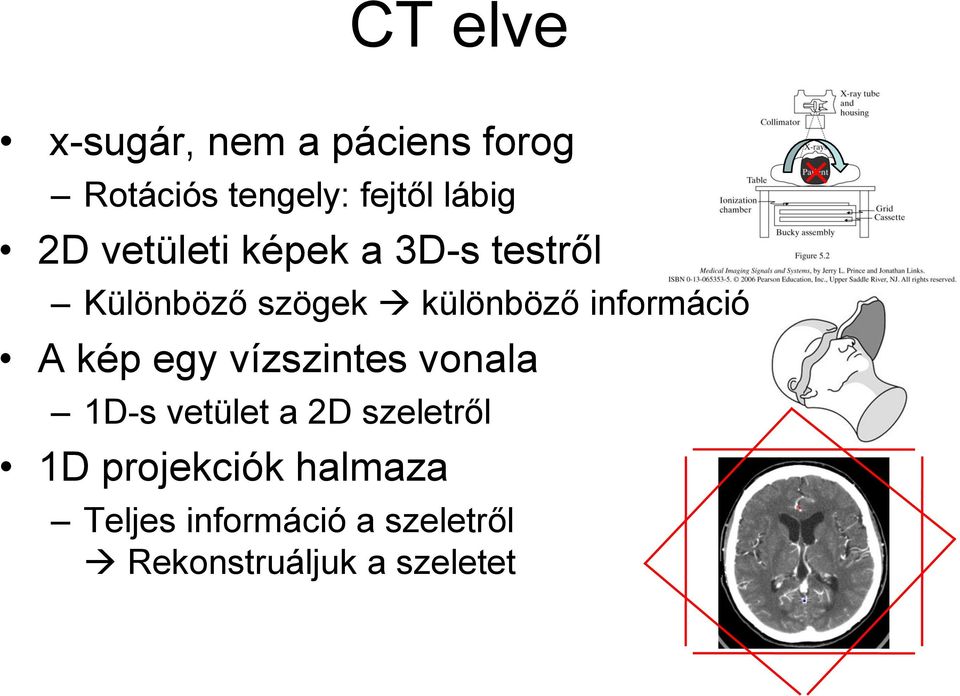 információ A kép egy vízszintes vonala 1D-s vetület a 2D szeletről