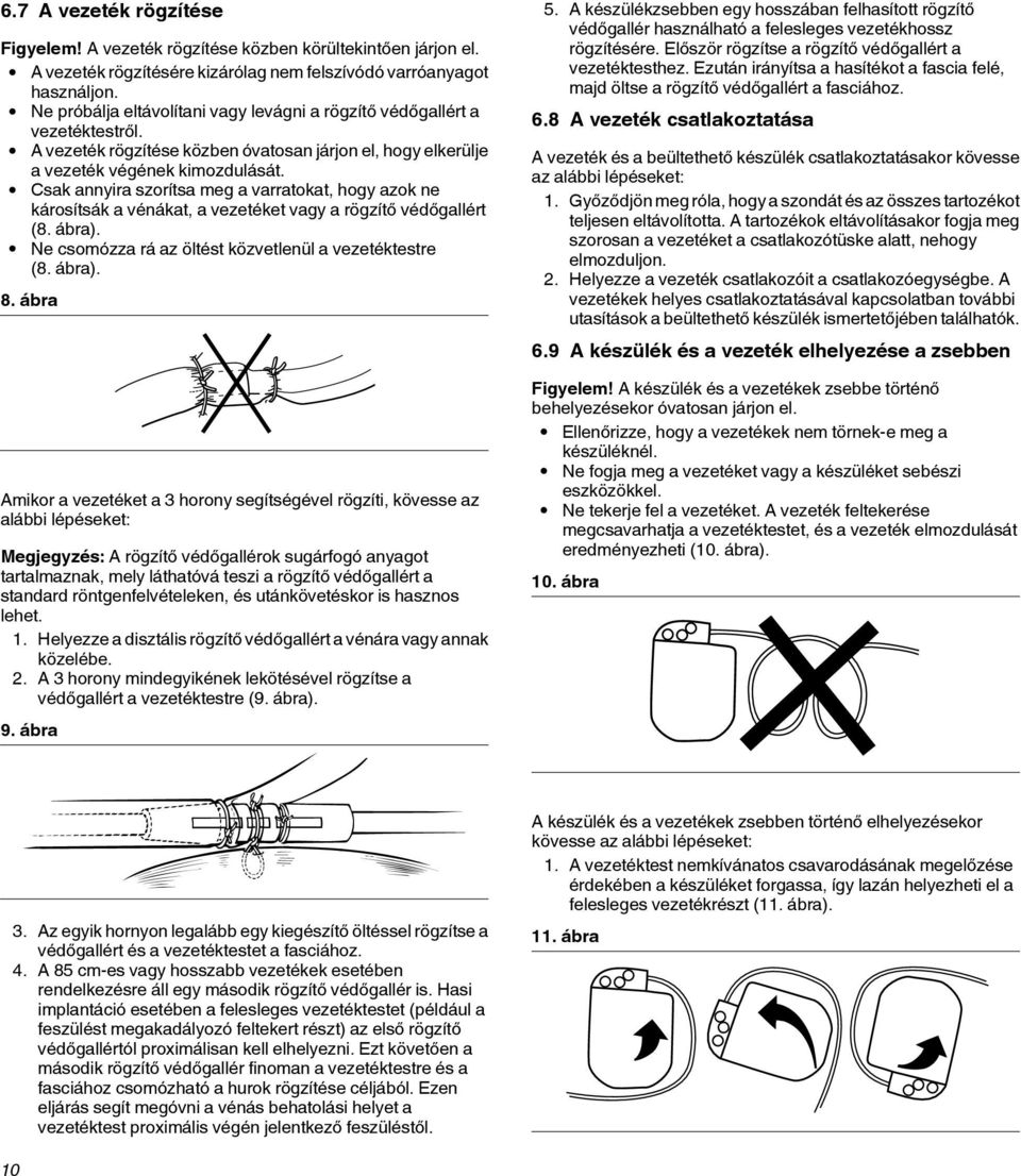 Csak annyira szorítsa meg a varratokat, hogy azok ne károsítsák a vénákat, a vezetéket vagy a rögzítő védőgallért (8. ábra). Ne csomózza rá az öltést közvetlenül a vezetéktestre (8. ábra). 8.