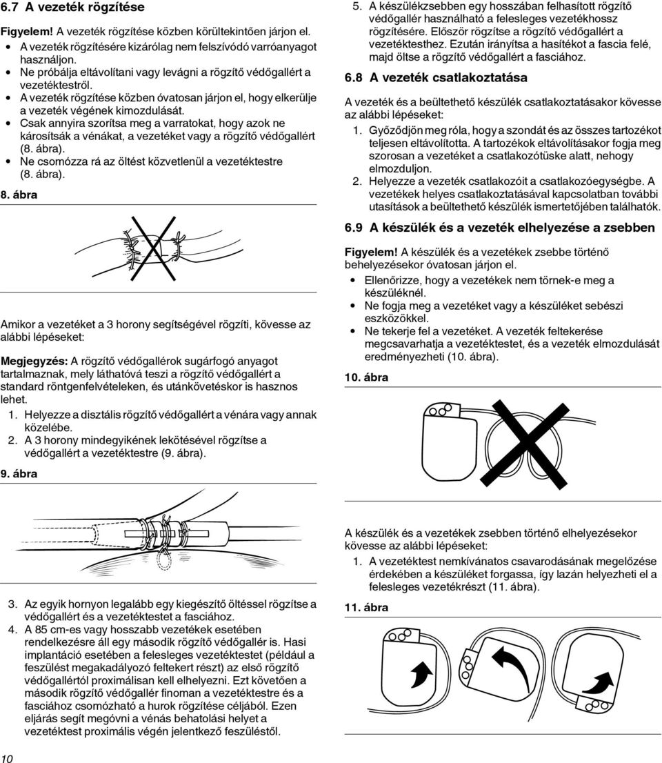 Csak annyira szorítsa meg a varratokat, hogy azok ne károsítsák a vénákat, a vezetéket vagy a rögzítő védőgallért (8. ábra). Ne csomózza rá az öltést közvetlenül a vezetéktestre (8. ábra). 8.