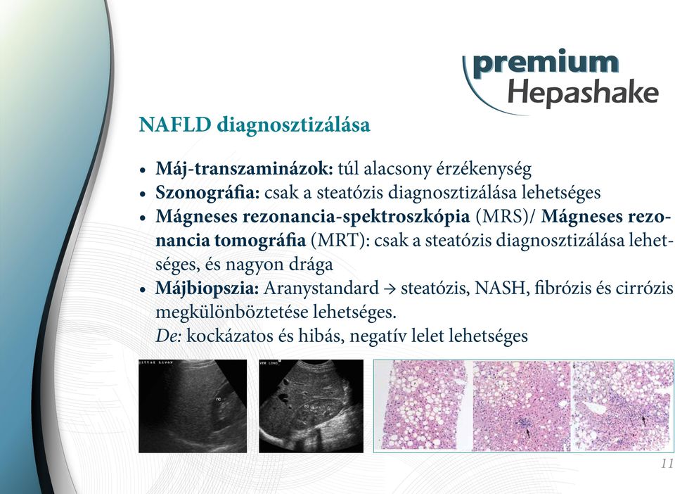 (MRT): csak a steatózis diagnosztizálása lehetséges, és nagyon drága Májbiopszia: Aranystandard