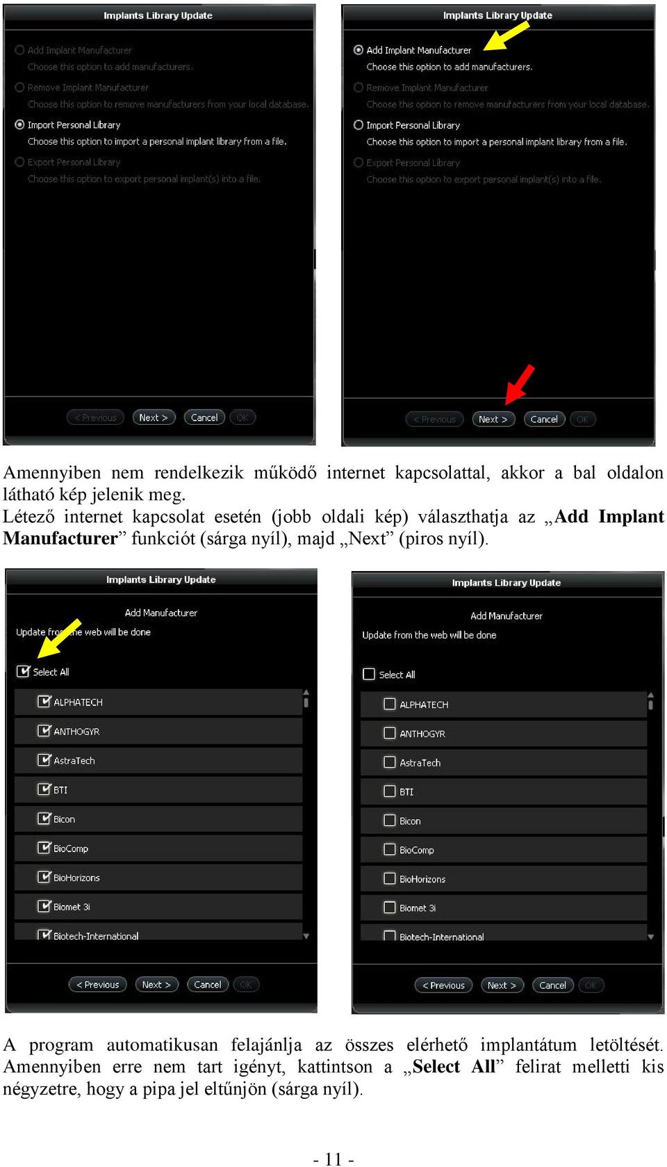 nyíl), majd Next (piros nyíl). A program automatikusan felajánlja az összes elérhető implantátum letöltését.