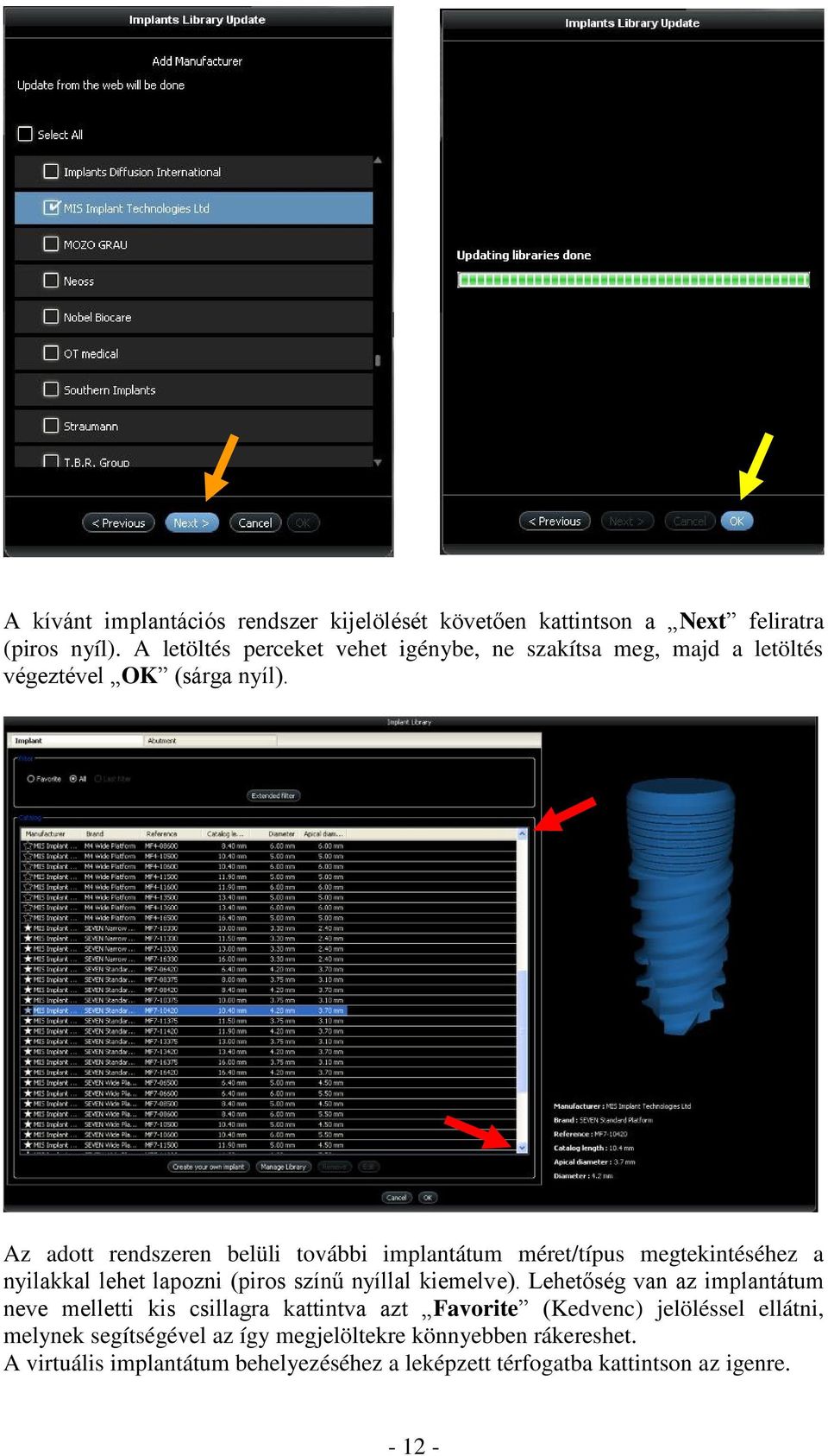 Az adott rendszeren belüli további implantátum méret/típus megtekintéséhez a nyilakkal lehet lapozni (piros színű nyíllal kiemelve).