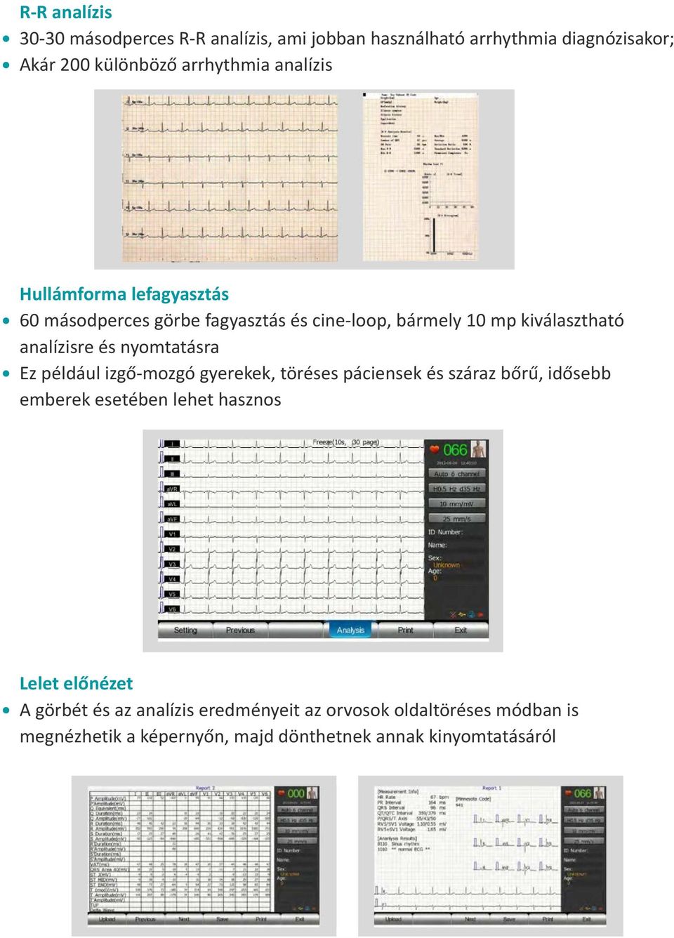 nyomtatásra Ez például izgő-mozgó gyerekek, töréses páciensek és száraz bőrű, idősebb emberek esetében lehet hasznos Lelet