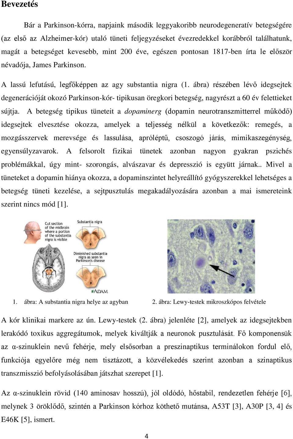 ábra) részében lévő idegsejtek degenerációját okozó Parkinson-kór- tipikusan öregkori betegség, nagyrészt a 60 év felettieket sújtja.