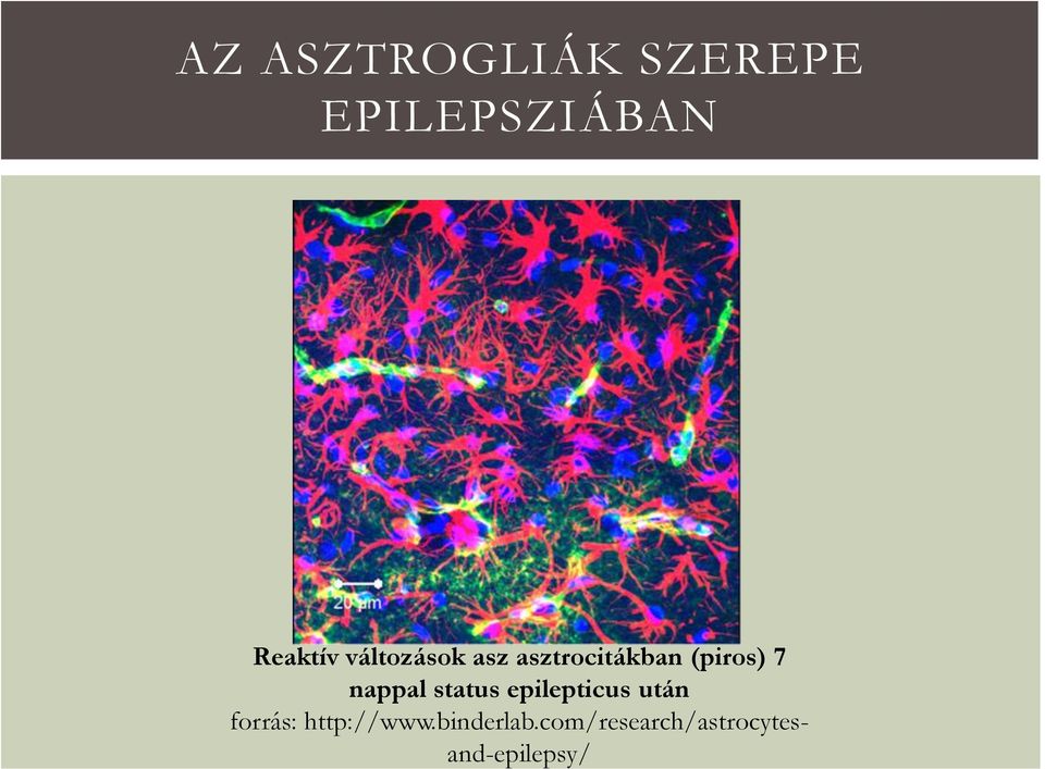 nappal status epilepticus után forrás: