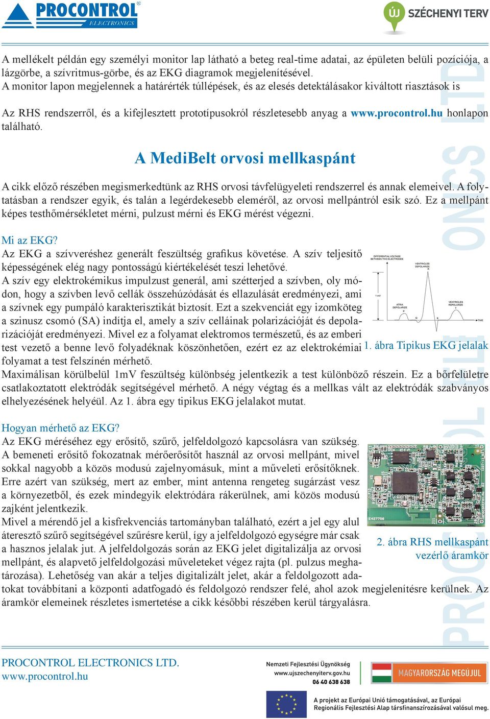 A MediBelt orvosi mellkaspánt A cikk előző részében megismerkedtünk az RHS orvosi távfelügyeleti rendszerrel és annak elemeivel.