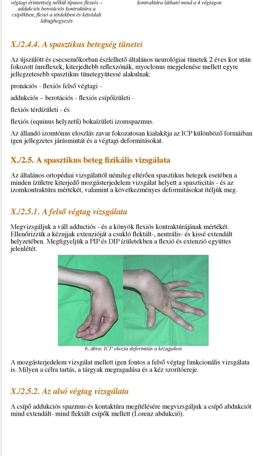 4. A spasztikus betegség tünetei Az újszülött és csecsemőkorban észlelhető általános neurológiai tünetek 2 éves kor után fokozott ínreflexek, kiterjedtebb reflexzónák, myoclonus megjelenése mellett