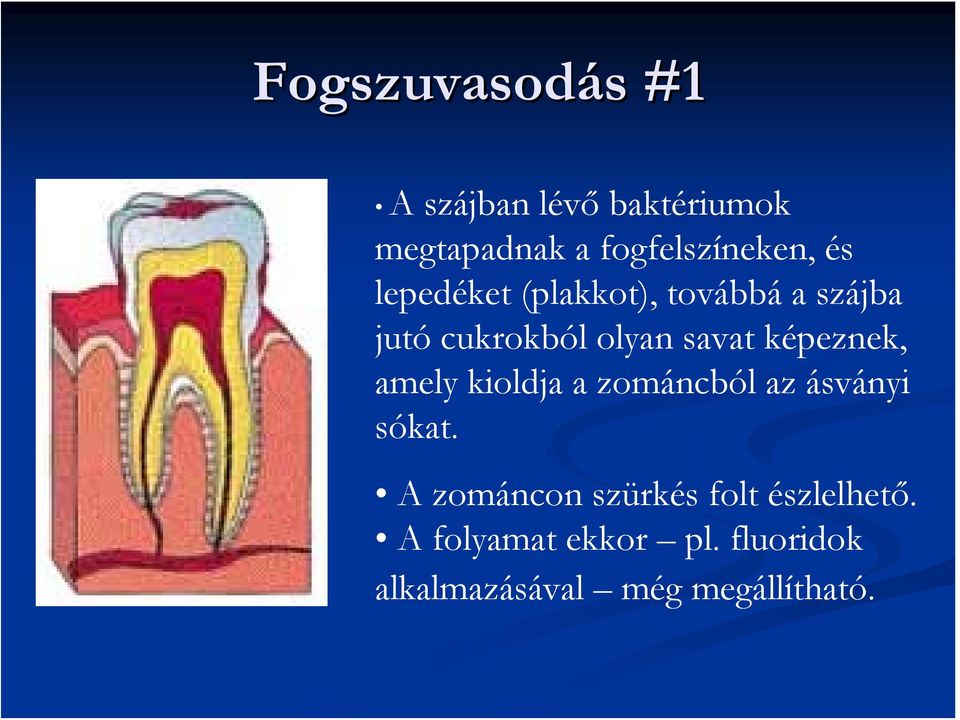 képeznek, amely kioldja a zománcból az ásványi sókat.