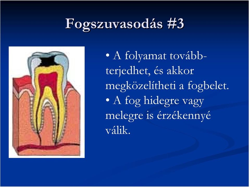 megközelítheti a fogbelet.