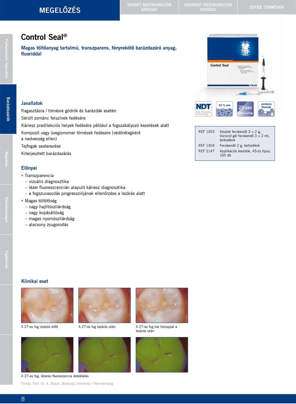 tömések fedésére (védőrétegként a nedvesség ellen) Tejfogak sealerezése Kiterjesztett barázdazárás Transzparencia vizuális diagnosztika lézer fluoreszcencián alapuló káriesz diagnosztika a