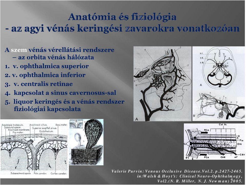 liqur keringés és a vénás rendszer fizilógiai kapcslata Valerie Purvin: Venus Occlusive